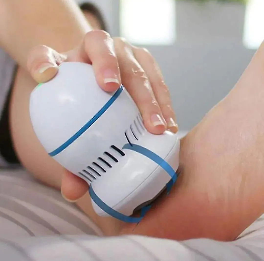 Electric Callus Remover – Smooth Feet in 60 Seconds | مبرد كهربائي للكعوب - ينعم القدمين خلال 60 ثانية